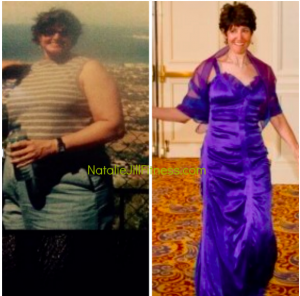 Weight Loss Success - Renee's Story BEFORE AND AFTER