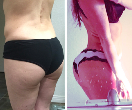 booty before and after