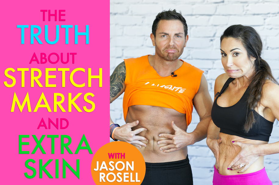 truth about stretch marks and extra skin jason rosell