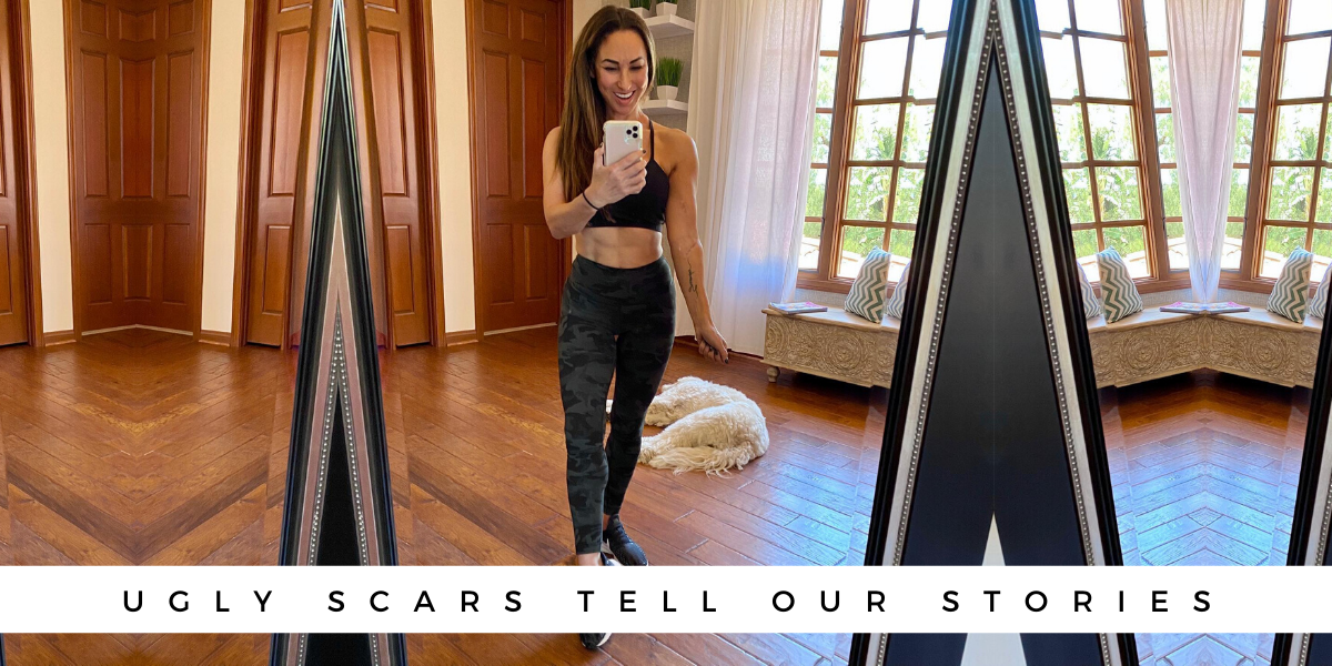 Ugly Scars Tell Our Stories blog thumbnail