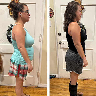 nj-before-after-1-Kristen