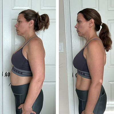 nj-before-after-2-Emily-Schultz