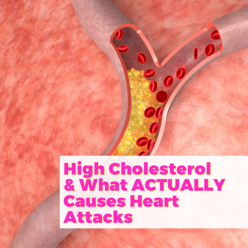 High Cholesterol and What ACTUALLY Causes Heart Attacks with Cardiologist Dr. Joel Kahn