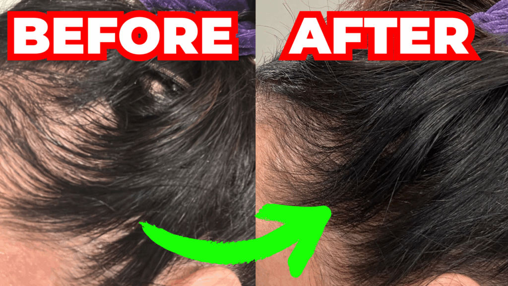 before and after one skin midlife hair loss solution natalie jill