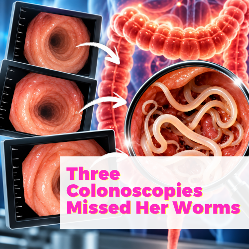 Three Colonoscopies Missed Her Worms with Kim Rogers